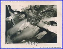 RARE WW2 Medical Dissection Autopsy Photo Japanese Cadaver Macabre Historic 1942